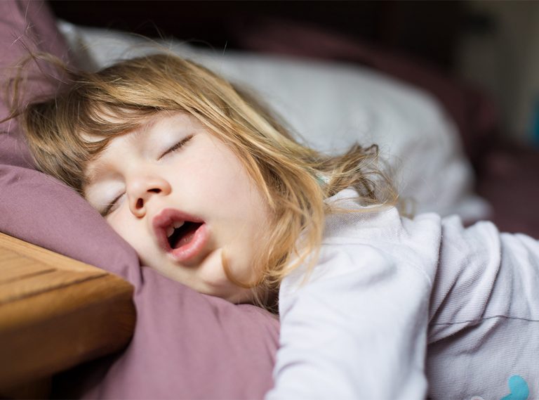 Snoring in children