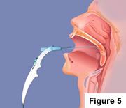 Sleep Apnea & Snoring Treatment