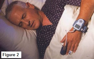 snoring treatment